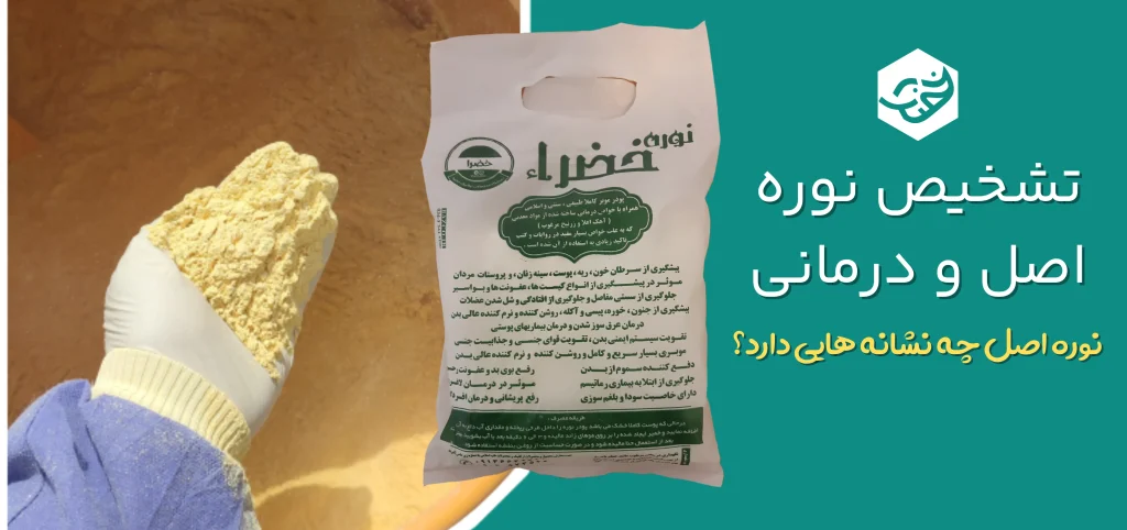 تشخیص نوره زرنیخ دار اصل