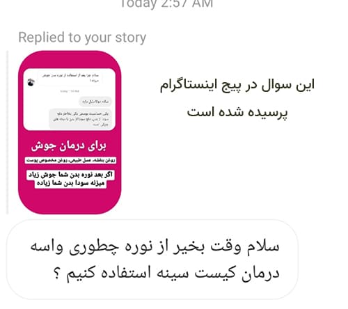 نوره برای کیست تخمدان