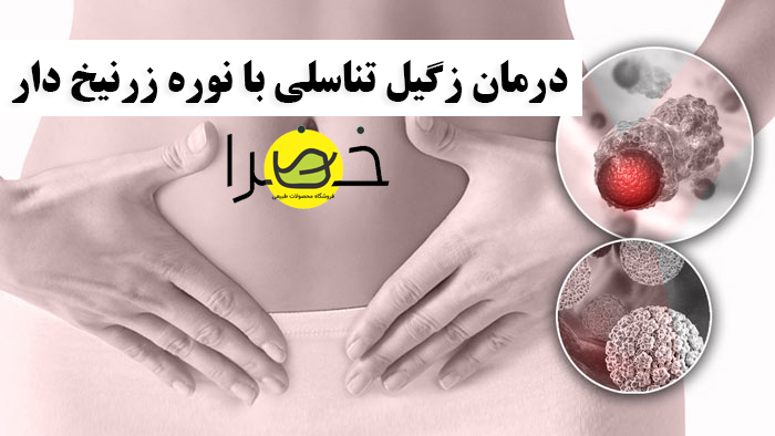 درمان زگیل تناسلی با نوره
