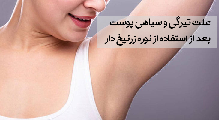 سیاهی جای نوره